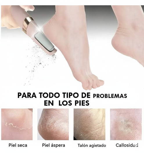Removedor de Callos Eléctrico Portátil Recargable