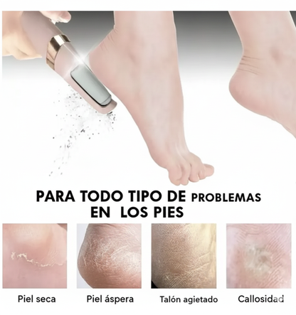 Removedor de Callos Eléctrico Portátil Recargable